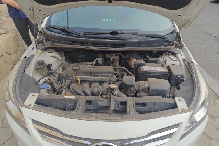 Used Hyundai Verna (older generation) 2014 1.4L Manual Smart GLS Trim Engine Bay