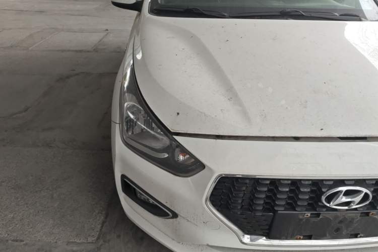 Used Hyundai Verna (older generation) 2017 1.4L Automatic YueXiang Edition China V-standard Right Front Headlight