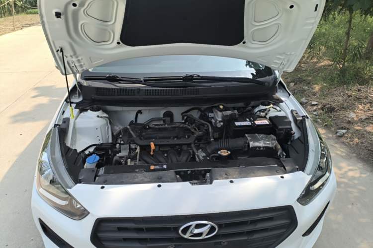 Used Hyundai Verna (older generation) 2020 1.4L Manual GL Refreshed Edition Engine Bay